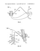 Systems and Methods For Placement of Valve Prosthesis System diagram and image