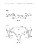 Systems and Methods For Placement of Valve Prosthesis System diagram and image