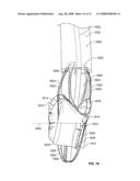 Systems and Methods For Placement of Valve Prosthesis System diagram and image