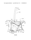 Systems and Methods For Placement of Valve Prosthesis System diagram and image