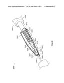 Systems and Methods For Placement of Valve Prosthesis System diagram and image