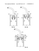Valve Prosthesis Systems and Methods diagram and image