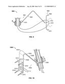 Valve Prosthesis Systems and Methods diagram and image