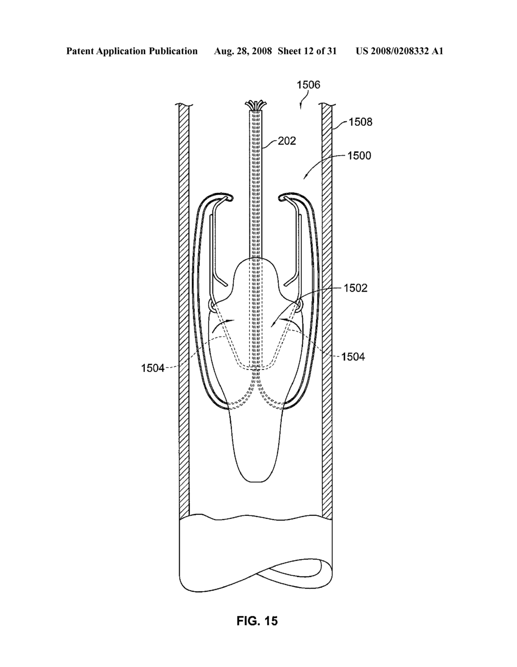 Valve Prosthesis Systems and Methods - diagram, schematic, and image 13