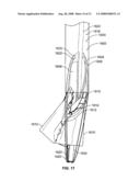 Valve Prosthesis Systems and Methods diagram and image