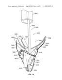 Valve Prosthesis Systems and Methods diagram and image