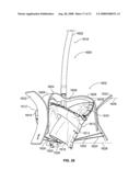 Valve Prosthesis Systems and Methods diagram and image