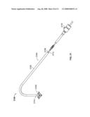 Valve Prosthesis Systems and Methods diagram and image