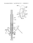 Valve Prosthesis Systems and Methods diagram and image