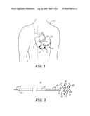 IMPLANTABLE MEDICAL DEVICE SYSTEM WITH FIXATION MEMBER diagram and image