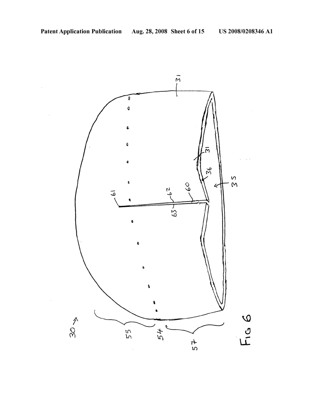 Prosthesis for interpositional location between bone joint articular surfaces and method of use - diagram, schematic, and image 07