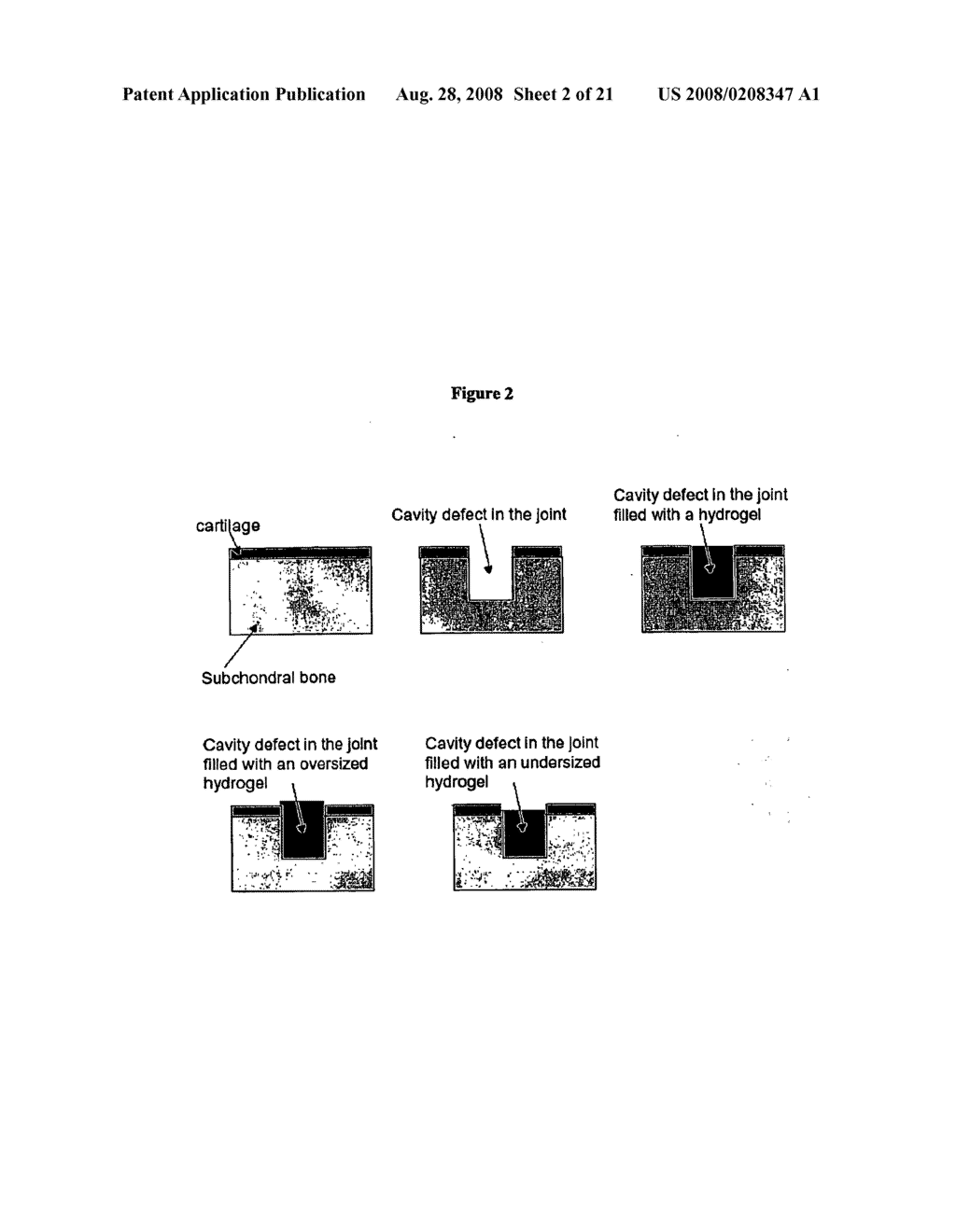 Tough Hydrogels - diagram, schematic, and image 03