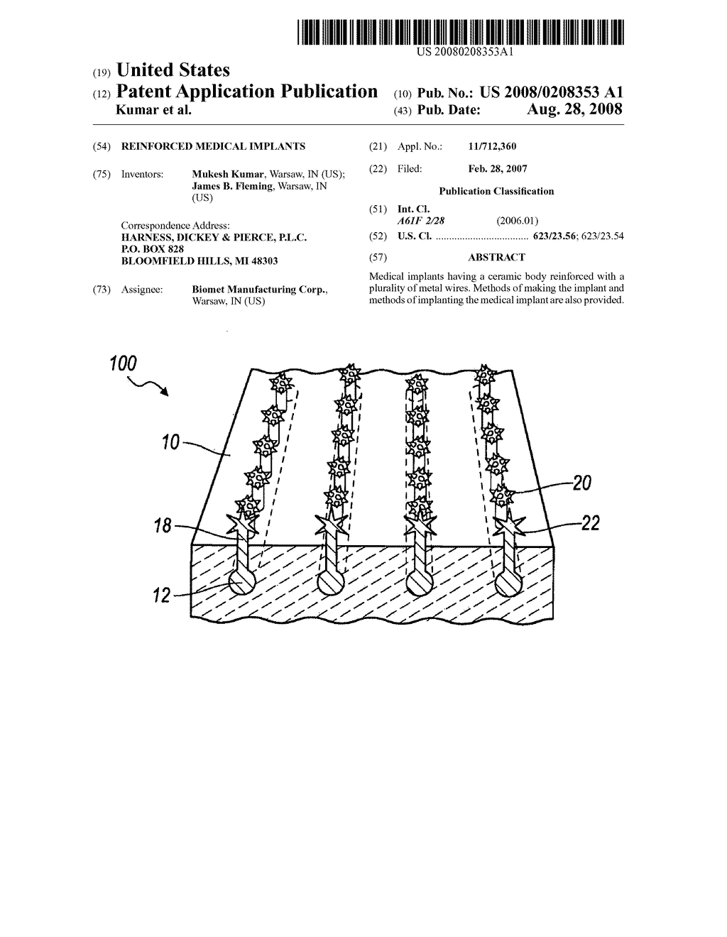 Reinforced medical implants - diagram, schematic, and image 01