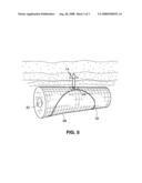 System and method for anchoring stomach implant diagram and image