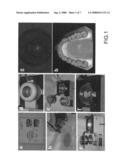 Bruxism Evaluating Sheet diagram and image