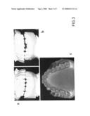 Bruxism Evaluating Sheet diagram and image