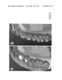 Bruxism Evaluating Sheet diagram and image