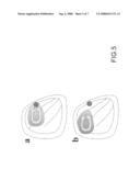 Bruxism Evaluating Sheet diagram and image