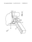 Infinitely Configurable RF Receive Coil diagram and image