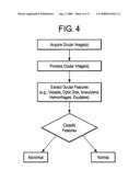 Noninvasive ocular monitor and method for measuring and analyzing physiological data diagram and image