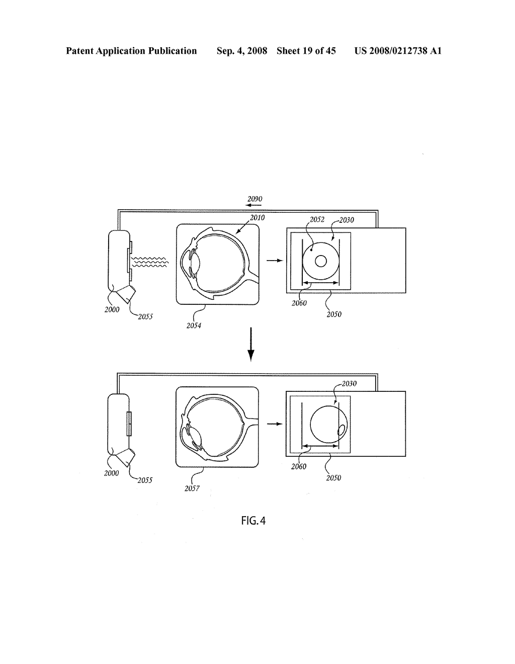 ORTHOVOLTAGE RADIOTHERAPY - diagram, schematic, and image 20