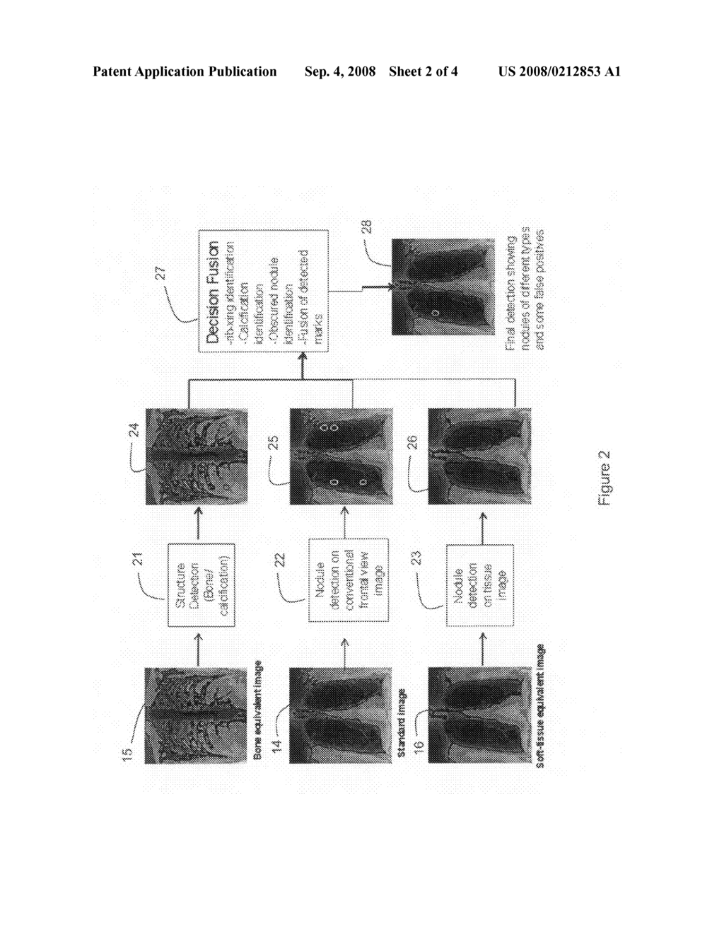 Computer Aided Diagnosis Using Dual Energy Subtraction Images - diagram, schematic, and image 03