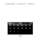 Method for monitoring blood flow and metabolic uptake in tissue with radiolabeled alkanoic acid diagram and image