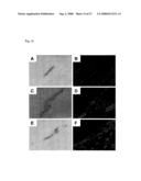 Pluripotent Stem Cell Cloned From Single Cell Derived From Skeletal Muscle Tissue diagram and image