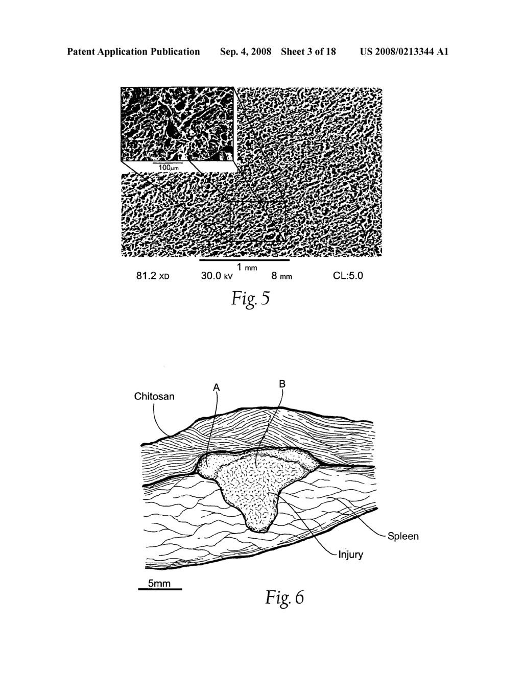 Wound dressing and method for controlling severe, life-threatening bleeding - diagram, schematic, and image 04