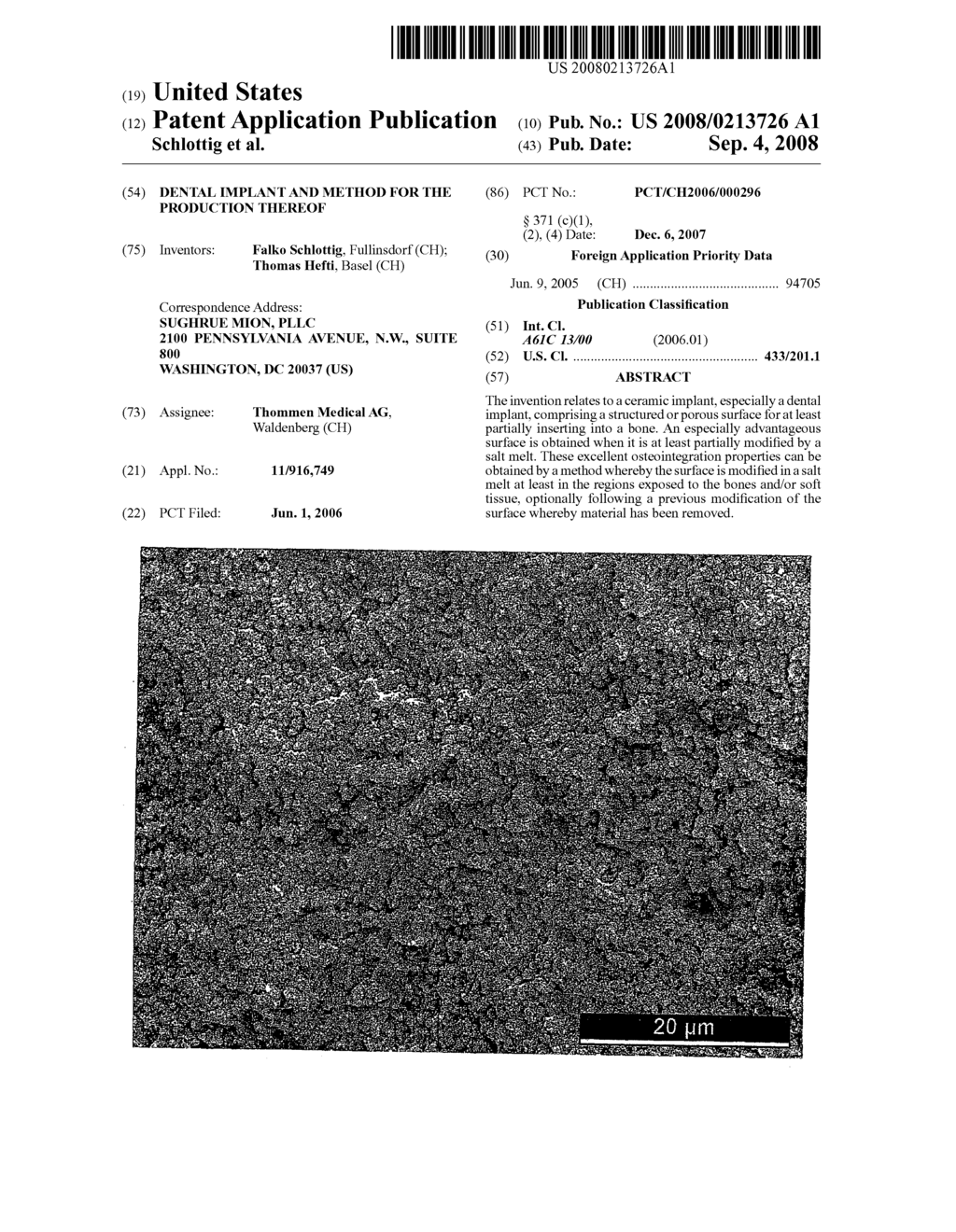 Dental Implant and Method for the Production Thereof - diagram, schematic, and image 01