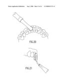 DEVICES AND METHODS OF APPLYING DENTAL COMPOSITES diagram and image