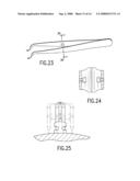 DEVICES AND METHODS OF APPLYING DENTAL COMPOSITES diagram and image