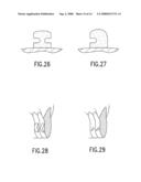 DEVICES AND METHODS OF APPLYING DENTAL COMPOSITES diagram and image