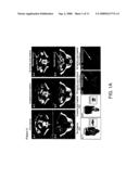 Mutations in Kit Confer Imatinib Resistance in Gastrointestinal Stromal Tumors diagram and image