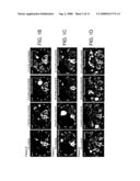 Mutations in Kit Confer Imatinib Resistance in Gastrointestinal Stromal Tumors diagram and image