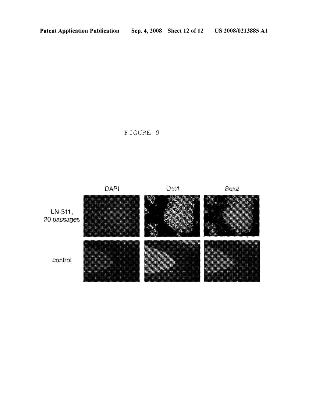 COMPOSITION AND METHOD FOR ENABLING PROLIFERATION OF PLURIPOTENT STEM CELLS - diagram, schematic, and image 13