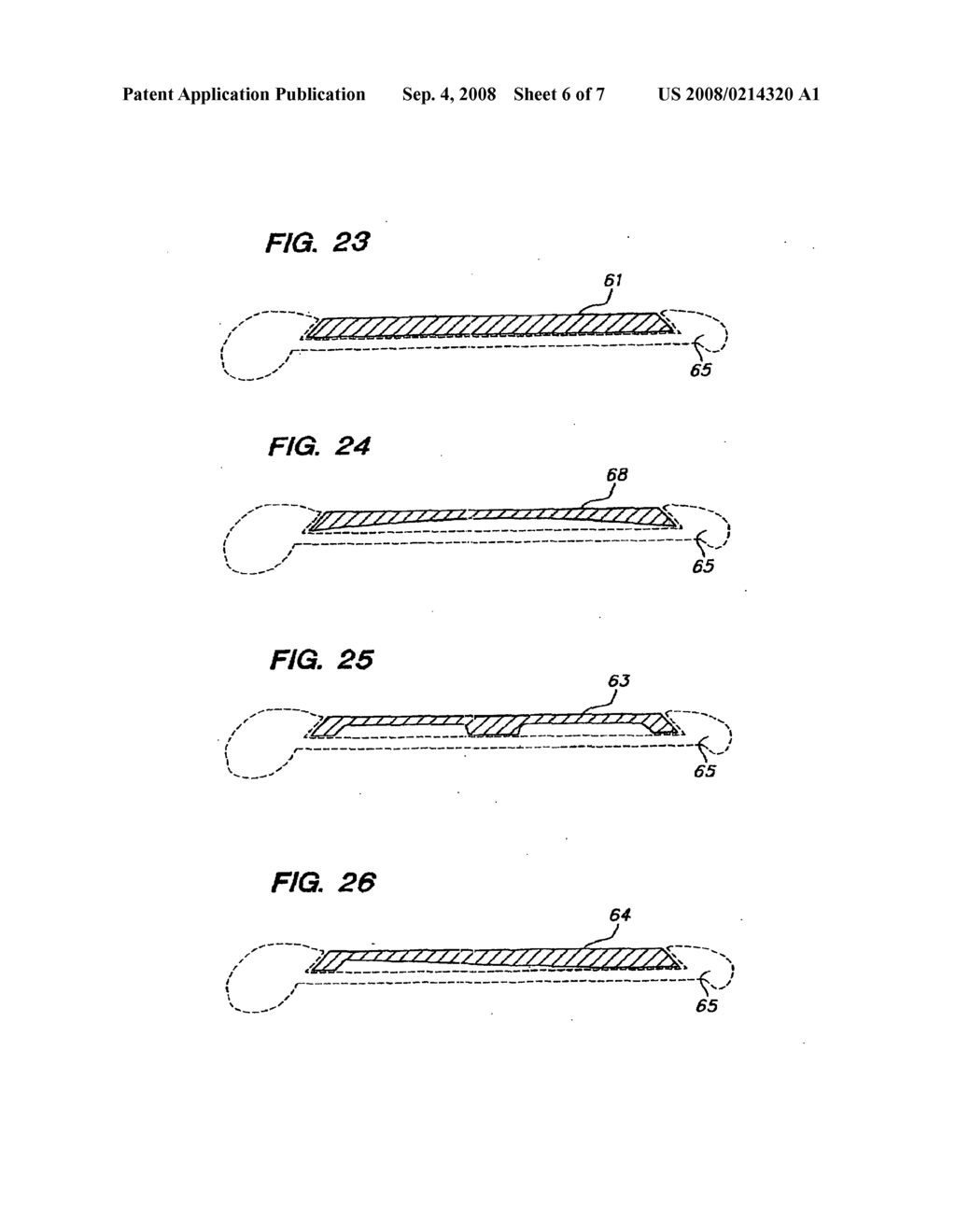 Golf club head - diagram, schematic, and image 07