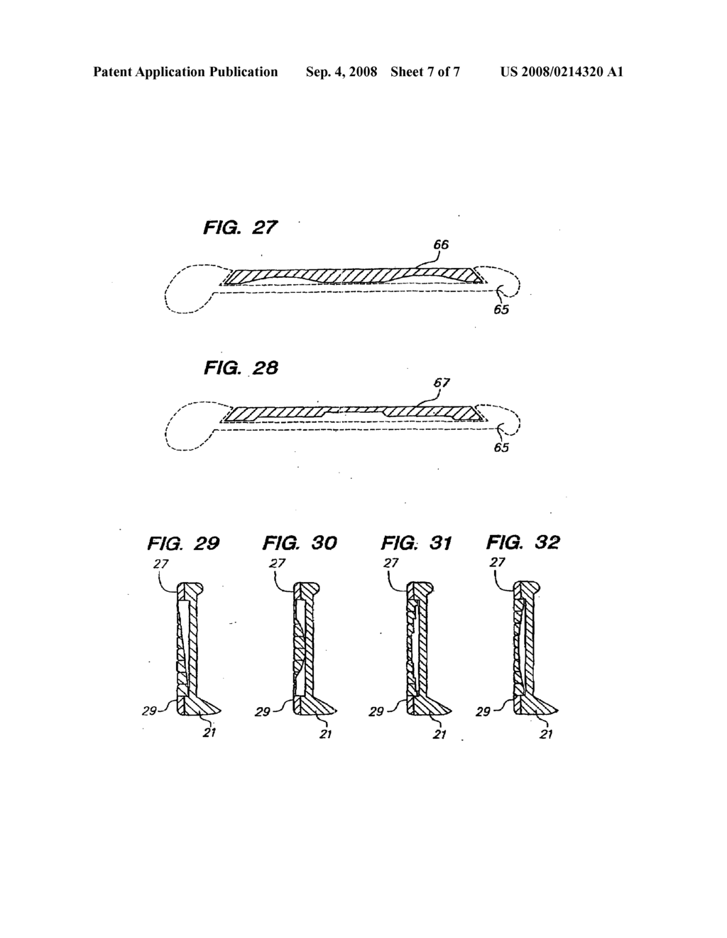 Golf club head - diagram, schematic, and image 08