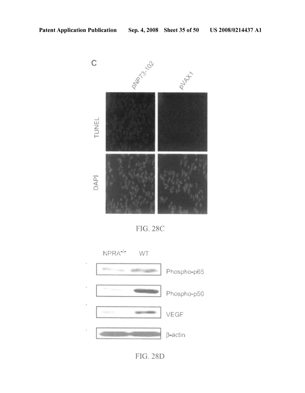 Methods and compositions for reducing activity of the atrial natriuretic peptide receptor and for treatment of diseases - diagram, schematic, and image 36