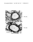 Small Peptides And Methods For Blocking IgE Mediated Activation Of An Immune Cell diagram and image