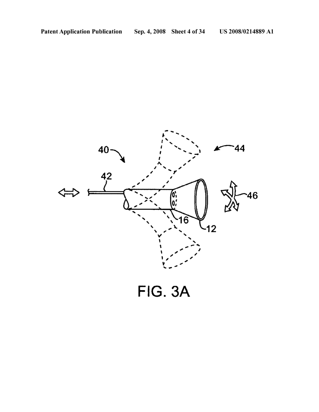 METHODS AND APPARATUS FOR PREVENTING TISSUE MIGRATION - diagram, schematic, and image 05