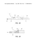 Therapeutic method and therapeutic system used with steps for approaching to lesion using overtube diagram and image