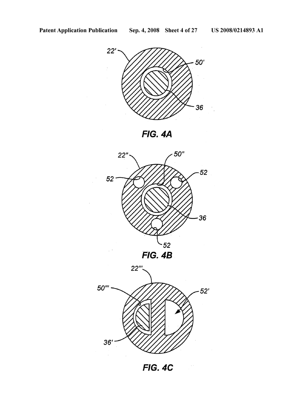 ENDOSCOPE WITH ADJACENTLY POSITIONED GUIDING APPARATUS - diagram, schematic, and image 05