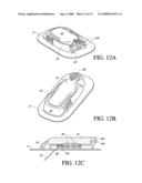 TRANSCUTANEOUS ANALYTE SENSOR diagram and image