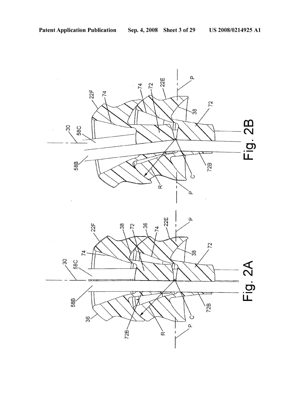 DEVICE FOR PRECISION POSITIONING OF INSTRUMENTS AT A MRI SCANNER - diagram, schematic, and image 04