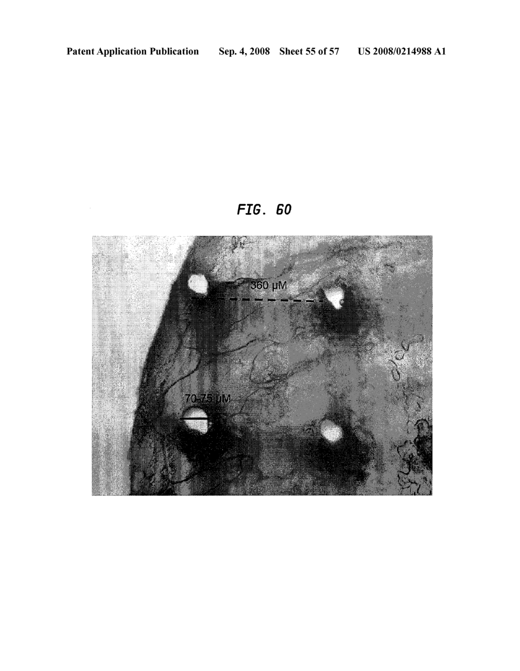 Methods And Devices For Fractional Ablation Of Tissue - diagram, schematic, and image 56