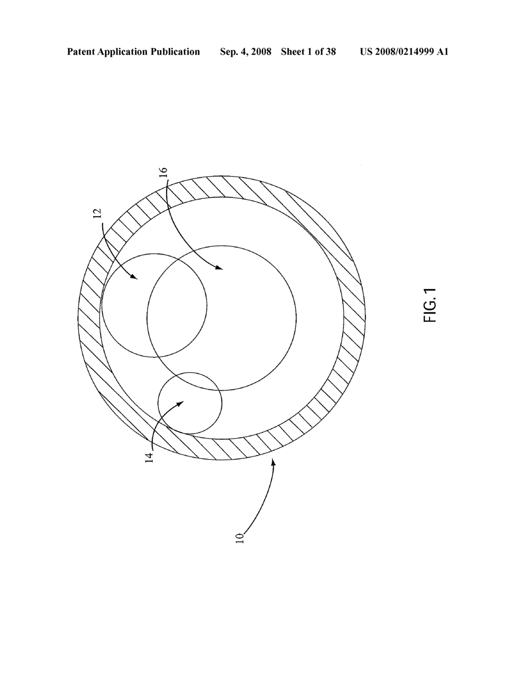 ANGIOPLASTY DEVICE AND METHOD OF MAKING SAME - diagram, schematic, and image 02