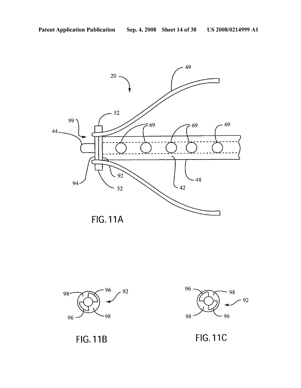ANGIOPLASTY DEVICE AND METHOD OF MAKING SAME - diagram, schematic, and image 15