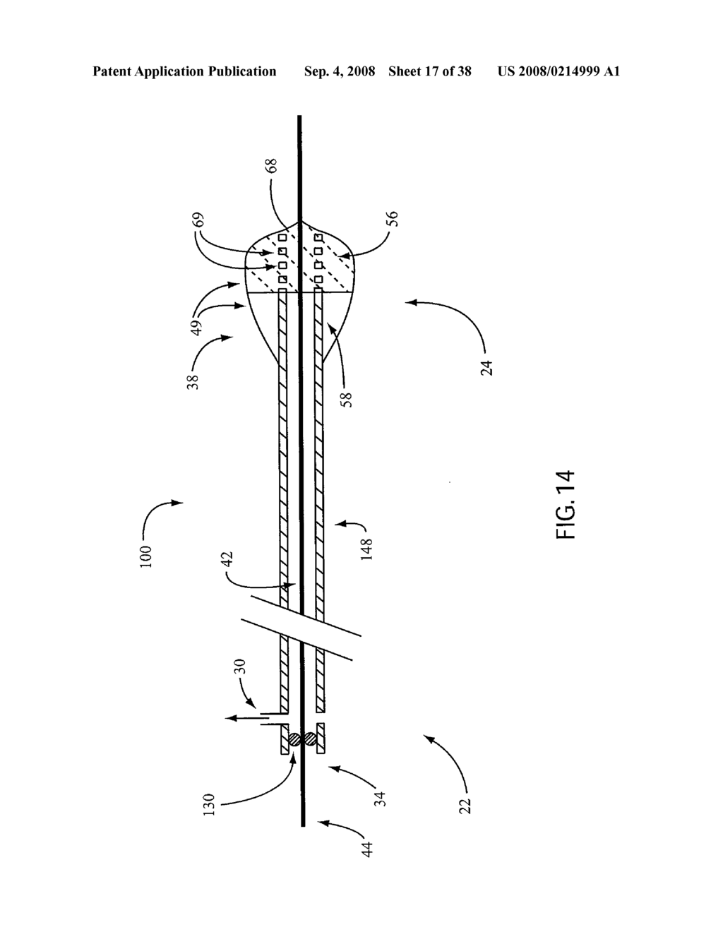 ANGIOPLASTY DEVICE AND METHOD OF MAKING SAME - diagram, schematic, and image 18