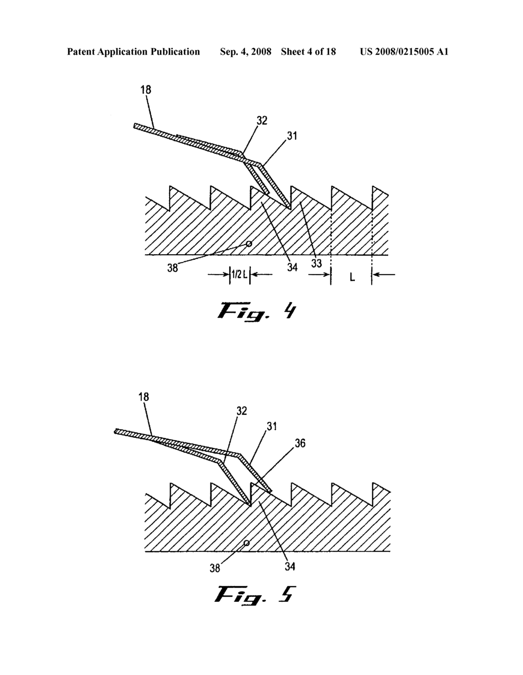 DRUG DELIVERY DEVICE - diagram, schematic, and image 05